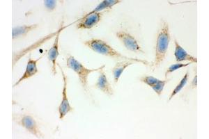 Immunohistochemistry (IHC) image for anti-Hydroxysteroid (17-Beta) Dehydrogenase 10 (HSD17B10) (AA 48-261) antibody (ABIN3031271)