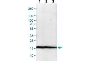 Western blot analysis of cell lysates with NME1-NME2 polyclonal antibody  at 1:100-1:500 dilution. (NME1 antibody)