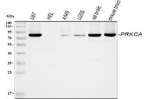 Western blot analysis of PKC alpha using anti-PKC alpha antibody (ABIN3043549). (PKC alpha antibody  (AA 153-342))