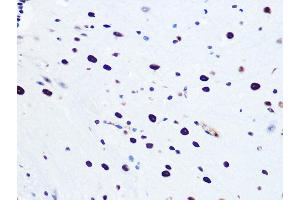 Immunohistochemistry of paraffin-embedded mouse spinal cord using DHX9/DHX9/RNA Helicase A Rabbit mAb (ABIN7265747) at dilution of 1:100 (40x lens). (DHX9 antibody)