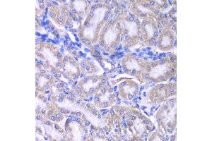 Immunohistochemistry of paraffin-embedded rat kidney using RMDN3 antibody at dilution of 1:200 (400x lens). (RMDN3 antibody)