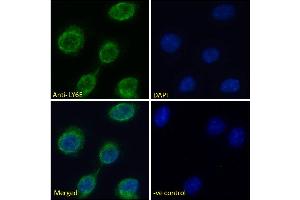 LY6E antibody  (Internal Region)