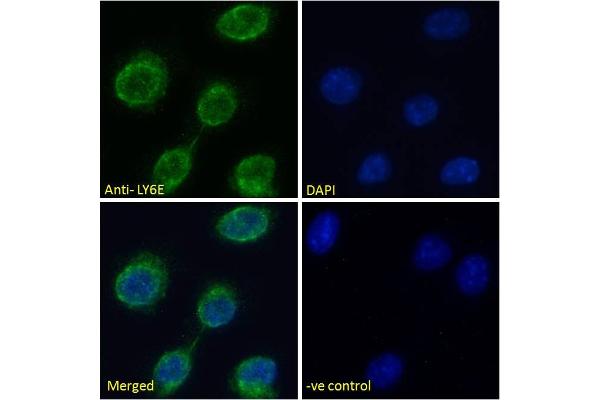 LY6E antibody  (Internal Region)