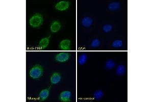 ABIN570878 Immunofluorescence analysis of paraformaldehyde fixed L929 cells (Mouse fibroblast cell line), permeabilized with 0. (LY6E antibody  (Internal Region))
