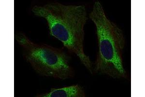 Immunocytochemistry (ICC) image for anti-Signal Transducer and Activator of Transcription 5A (STAT5A) (AA 583-794) antibody (ABIN1845625) (STAT5A antibody  (AA 583-794))