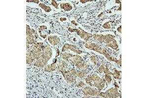 IHC analysis of RET using anti-RET antibody (ABIN6719502). (Ret Proto-Oncogene antibody  (AA 29-304))