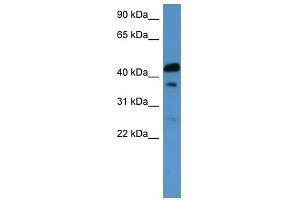 CALCR antibody used at 0. (Calcitonin Receptor antibody  (C-Term))