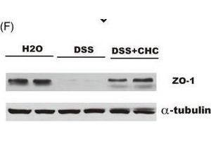 Administration of CHC ameliorates DSS-induced colitis in mice.