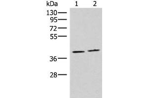 Western blot analysis of Human placenta tissue and Human fetal brain tissue lysates using HMGCLL1 Polyclonal Antibody at dilution of 1:1000 (HMGCLL1 antibody)