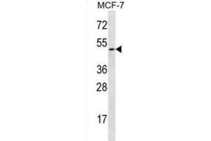 Western Blotting (WB) image for anti-Ladinin 1 (LAD1) antibody (ABIN2996996) (Ladinin 1 antibody)