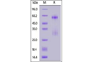 SDS-PAGE (SDS) image for SARS-CoV-2 Nucleocapsid (SARS-CoV-2 N) (Active) protein (His tag) (ABIN7013245)