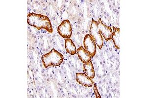 Immunohistochemistry (Paraffin-embedded Sections) (IHC (p)) image for anti-Linker For Activation of T Cells Family, Member 2 (LAT2) antibody (ABIN7074503)