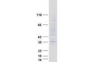 Western Blotting (WB) image for Transmembrane Protein 38A (TMEM38A) protein (Myc-DYKDDDDK Tag) (ABIN2733894)