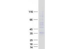 Validation with Western Blot (TMEM38A Protein (Myc-DYKDDDDK Tag))