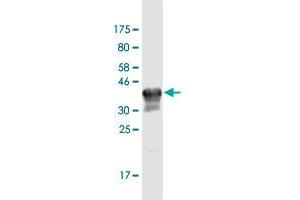 Western Blot detection against Immunogen (34. (Copine III antibody  (AA 164-244))