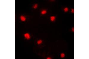 Immunofluorescent analysis of p21 (pT145) staining in HeLa cells.