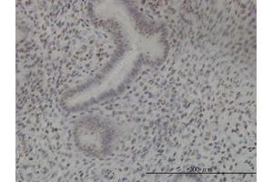 Image no. 4 for anti-NIMA (Never In Mitosis Gene A)-Related Kinase 11 (NEK11) (AA 1-483) antibody (ABIN599307) (NEK11 antibody  (AA 1-483))