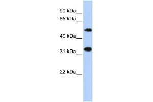 WB Suggested Anti-C6orf150 Antibody Titration: 0. (C6orf150 antibody  (Middle Region))