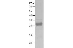 Western Blotting (WB) image for Hepcidin Antimicrobial Peptide (HAMP) (AA 24-84) protein (His-IF2DI Tag) (ABIN7283283) (Hepcidin Protein (AA 24-84) (His-IF2DI Tag))