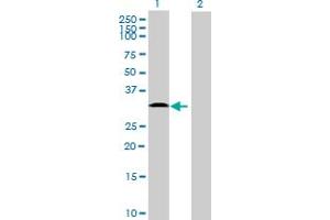 Western Blot analysis of TMEM40 expression in transfected 293T cell line ( H00055287-T01 ) by TMEM40 MaxPab polyclonal antibody. (TMEM40 antibody  (AA 1-203))
