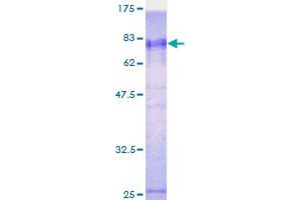 ZNF265 Protein (AA 1-320) (GST tag)