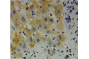 Used in DAB staining on fromalin fixed paraffin-embedded Liver tissue (Desmin antibody  (AA 117-348))