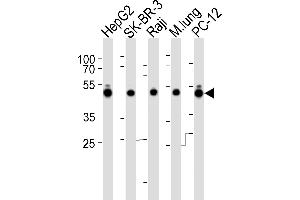Western blot analysis of lysates from HepG2, SK-BR-3, Raji cell line, mouse lung tissue lysate and rat PC-12 cell line (from left to right), using DNAJA1 Antibody (C-term) (ABIN6242850 and ABIN6577522). (DNAJA1 antibody  (C-Term))