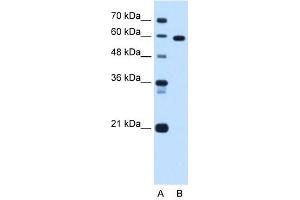 Western Blot showing TBX15 antibody used at a concentration of 1. (T-Box 15 antibody  (C-Term))