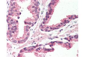 Anti-GPR126 antibody IHC of human prostate.