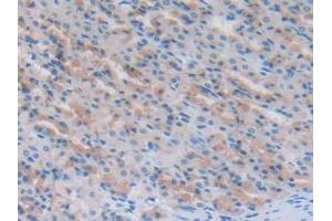 Detection of NT-ProANP in Rat Stomach Tissue using Polyclonal Antibody to N-Terminal Pro-Atrial Natriuretic Peptide (NT-ProANP) (PRO-ANP antibody  (AA 25-122))