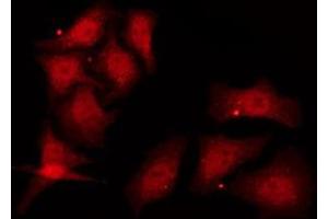 ABIN6278388 staining COS7 by IF/ICC. (TSG101 antibody)