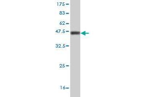 Western Blot detection against Immunogen (36. (KDM5A antibody  (AA 191-290))