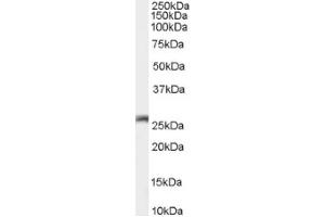 Image no. 1 for anti-Gap Junction Protein, beta 2, 26kDa (GJB2) (C-Term) antibody (ABIN374836) (GJB2 antibody  (C-Term))