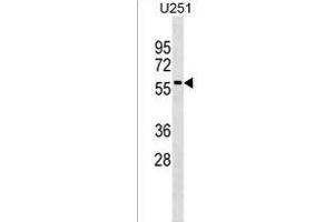 Rab9p40 Antibody (C-term) (ABIN1537097 and ABIN2838354) western blot analysis in  cell line lysates (35 μg/lane). (RABEPK antibody  (C-Term))