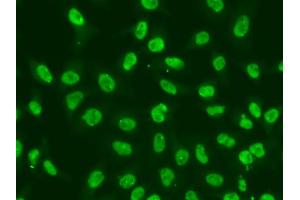 Immunofluorescence analysis of A549 cells using CHEK2 antibody (ABIN5971172).
