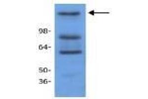 Image no. 1 for anti-Histone Deacetylase 9 (HDAC9) antibody (ABIN127248) (HDAC9 antibody)