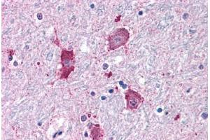 Anti-NPY5R antibody  ABIN1049126 IHC staining of human brain, neurons and glia. (NPY5R antibody  (Cytoplasmic Domain))