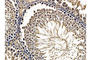 LAMB2 Mouse Monoclonal Antibody at 1/100 staining rat testis tissue by IHC-P.