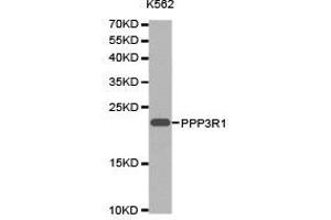 Western Blotting (WB) image for anti-Protein Phosphatase 3, Regulatory Subunit B, alpha (PPP3R1) antibody (ABIN1874237) (PPP3R1 antibody)
