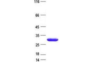 SULT6B1 Protein (His tag)