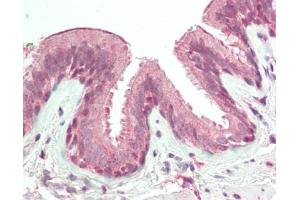 Human Lung: Formalin-Fixed, Paraffin-Embedded (FFPE). (RNF165 antibody  (AA 201-250))