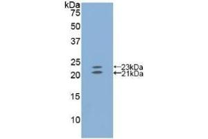 Detection of Recombinant EDN1, Mouse using Polyclonal Antibody to Endothelin 1 (EDN1) (Endothelin 1 antibody  (AA 33-202))