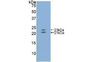 Detection of Recombinant EDN1, Mouse using Polyclonal Antibody to Endothelin 1 (EDN1) (Endothelin 1 antibody  (AA 33-202))