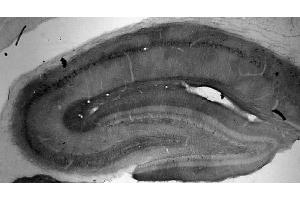 Adult rat hippocampus immunohistochemistry.