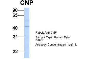 Western Blotting (WB) image for anti-2',3'-Cyclic Nucleotide 3' phosphodiesterase (CNP) (Middle Region) antibody (ABIN2778174)