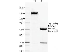 SDS-PAGE Analysis Purified Filaggrin Mouse Monoclonal Antibody (FLG/1563). (Filaggrin antibody  (AA 998-1104))
