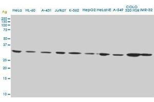 CD5L monoclonal antibody (M01), clone 1C8. (CD5L antibody  (AA 41-140))