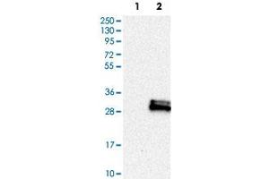 Western Blot analysis of Lane 1: negative control (vector only transfected HEK293T cell lysate) and Lane 2: over-expression lysate (co-expressed with a C-terminal myc-DDK tag in mammalian HEK293T cells) with PAEP polyclonal antibody .