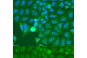 Immunofluorescence analysis of A549 cells using IRAK2 Polyclonal Antibody (IRAK2 antibody)