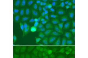 Immunofluorescence analysis of A549 cells using IRAK2 Polyclonal Antibody (IRAK2 antibody)
